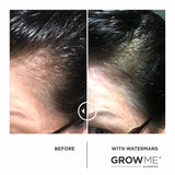 GROW MORE SCALP ELIXIR