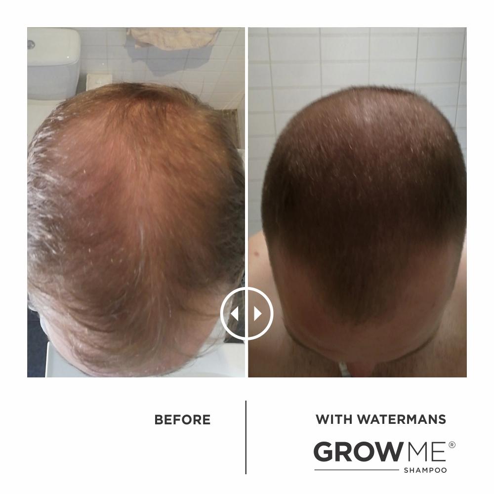 GROW MORE SCALP ELIXIR