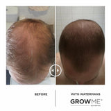 GROW MORE SCALP ELIXIR